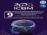 نهمین کنگره بین المللی نقشه برداری مغز ایران نهمین کنگره بین المللی نقشه برداری مغز ایران